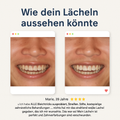 SONIQUA – Elektrische Schallzahnbürste