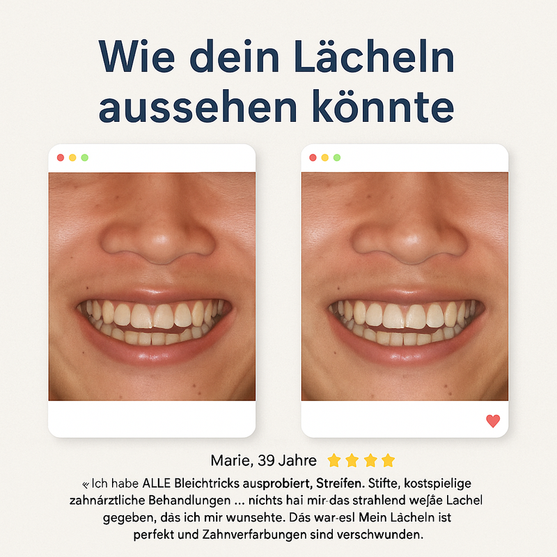 SONIQUA – Elektrische Schallzahnbürste