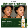 DOREA Kurkuma Gesichtstonic – Vitamin C gegen dunkle Flecken, für strahlende Haut