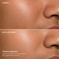 Niacinamid 10% + Zink 1% Serum – 30 ml